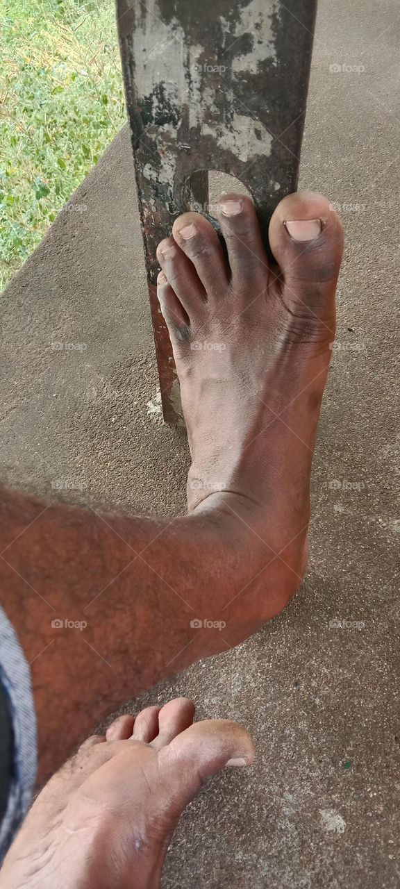 my foot