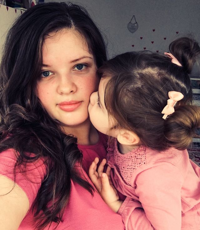 kisses 