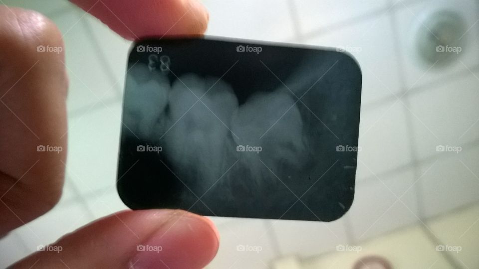 X-ray film teeth