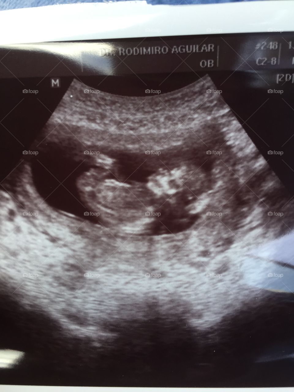 Bebé -baby 
12 semanas