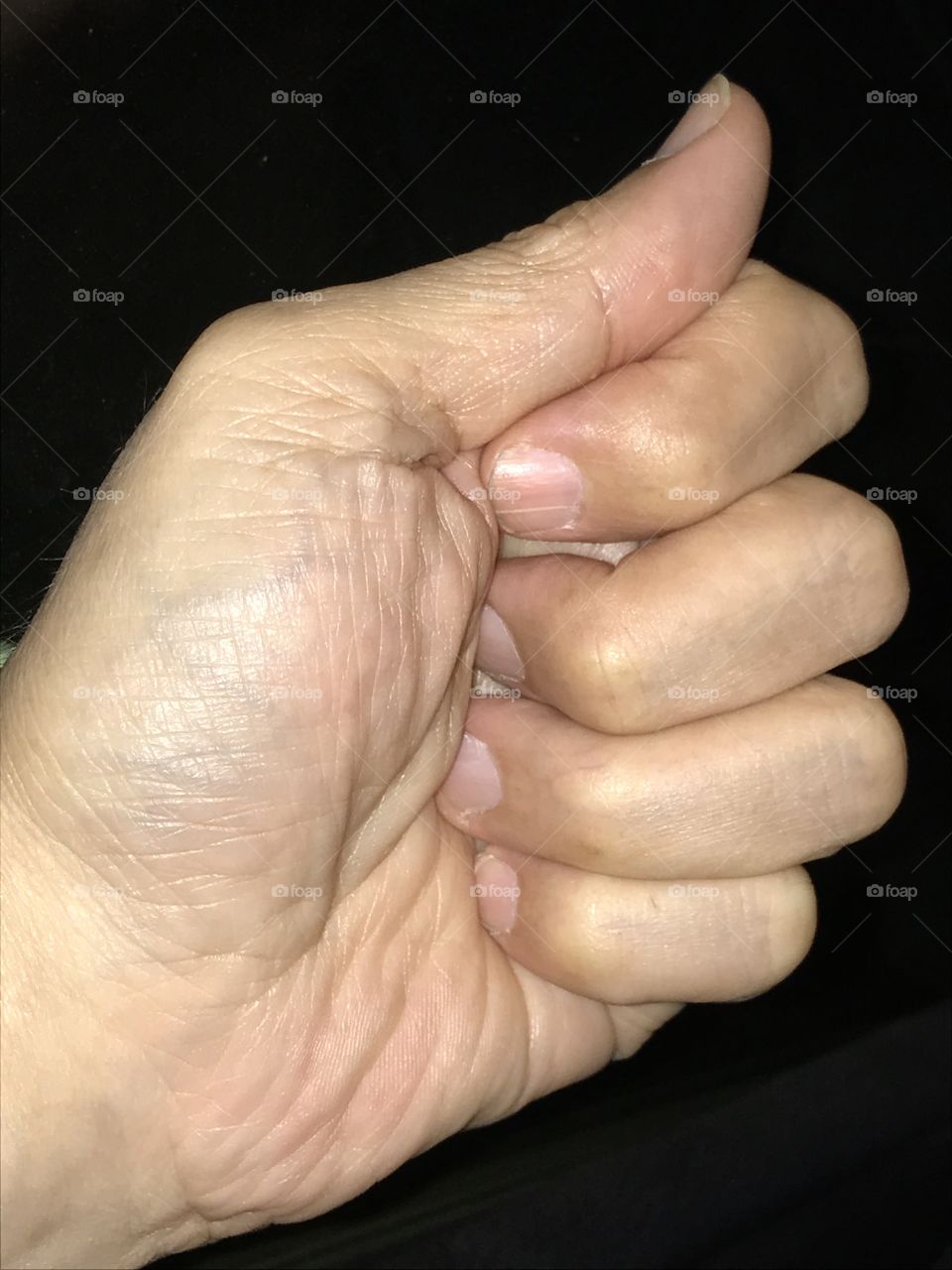 Boshiken. Japanese word meaning “thumb fist strike.” It is utilized in Japanese martial arts training.