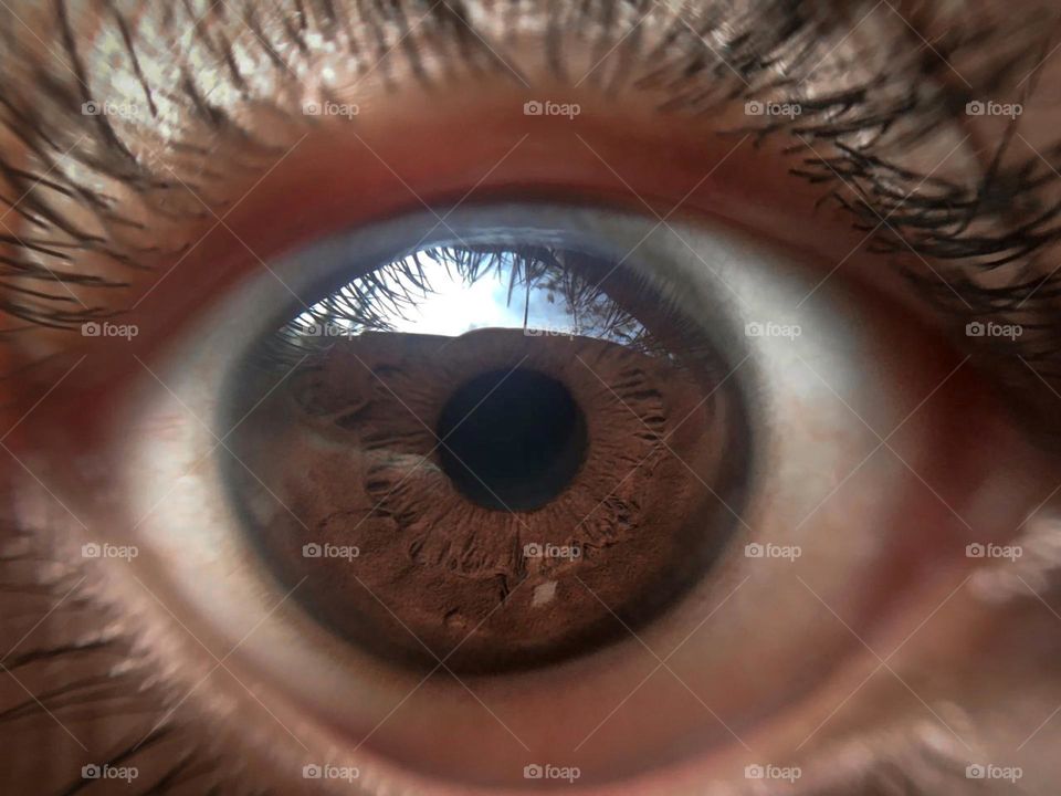 eye