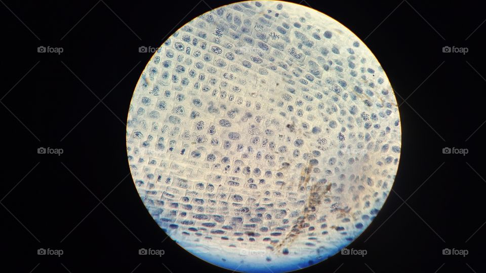 mitotic cells tip onion root under the microscope. Cell division.