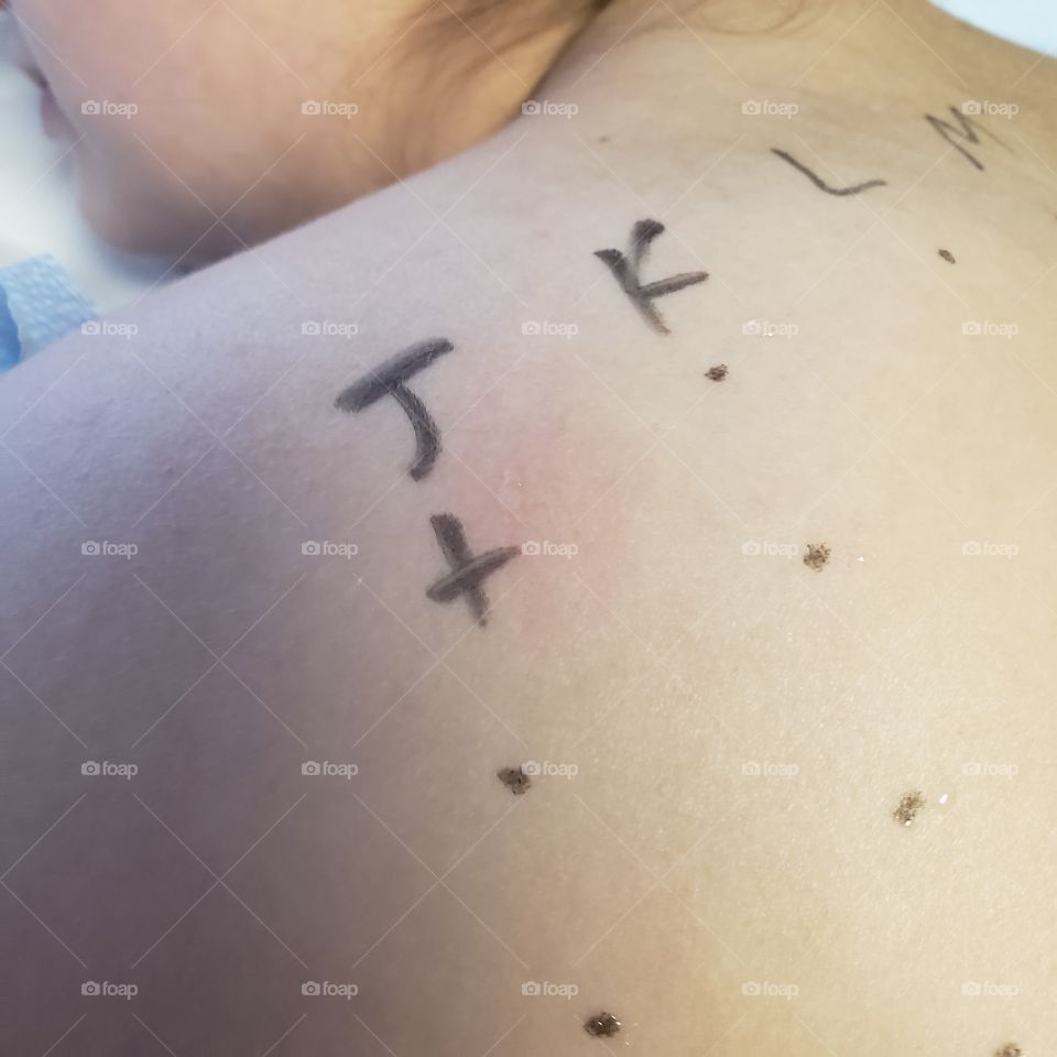 allergy testing