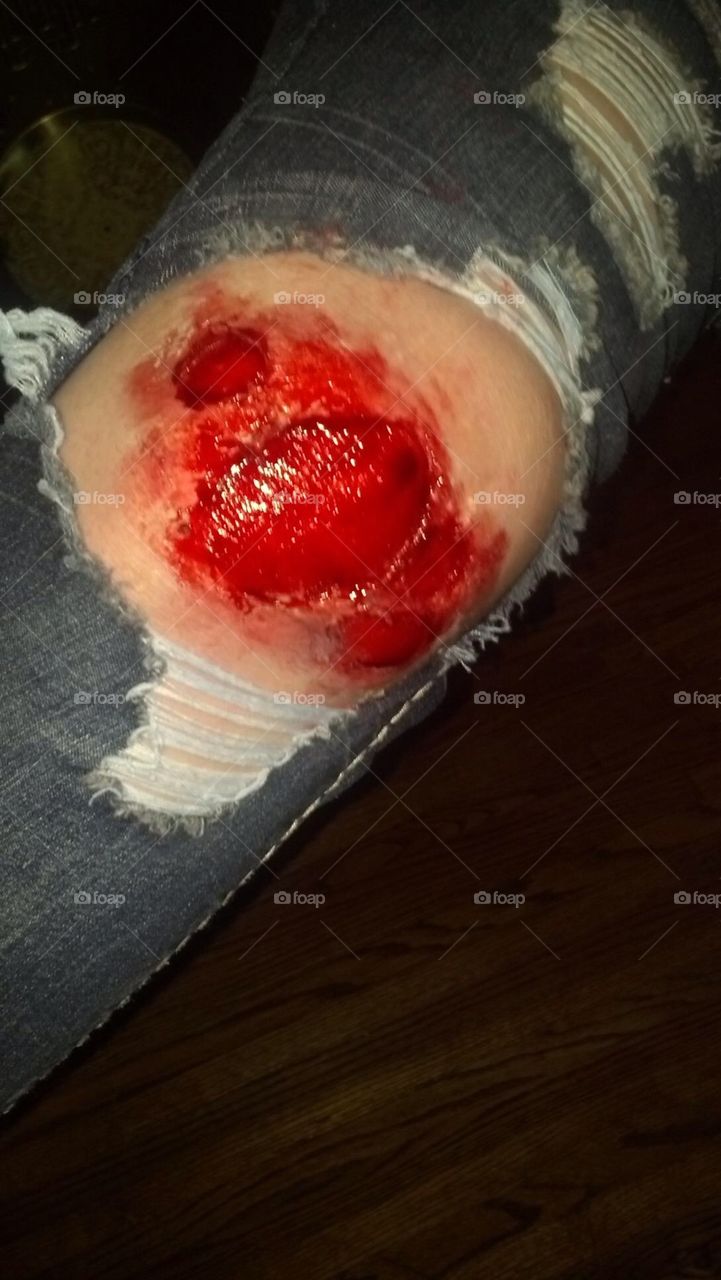 Latex wound 