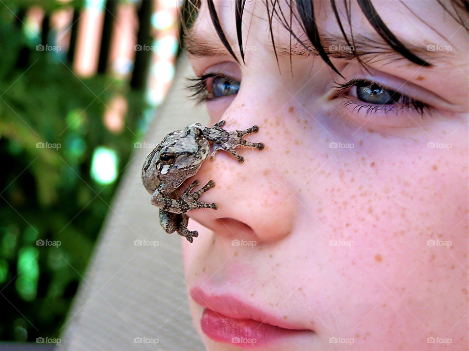 Frog on boy's nose