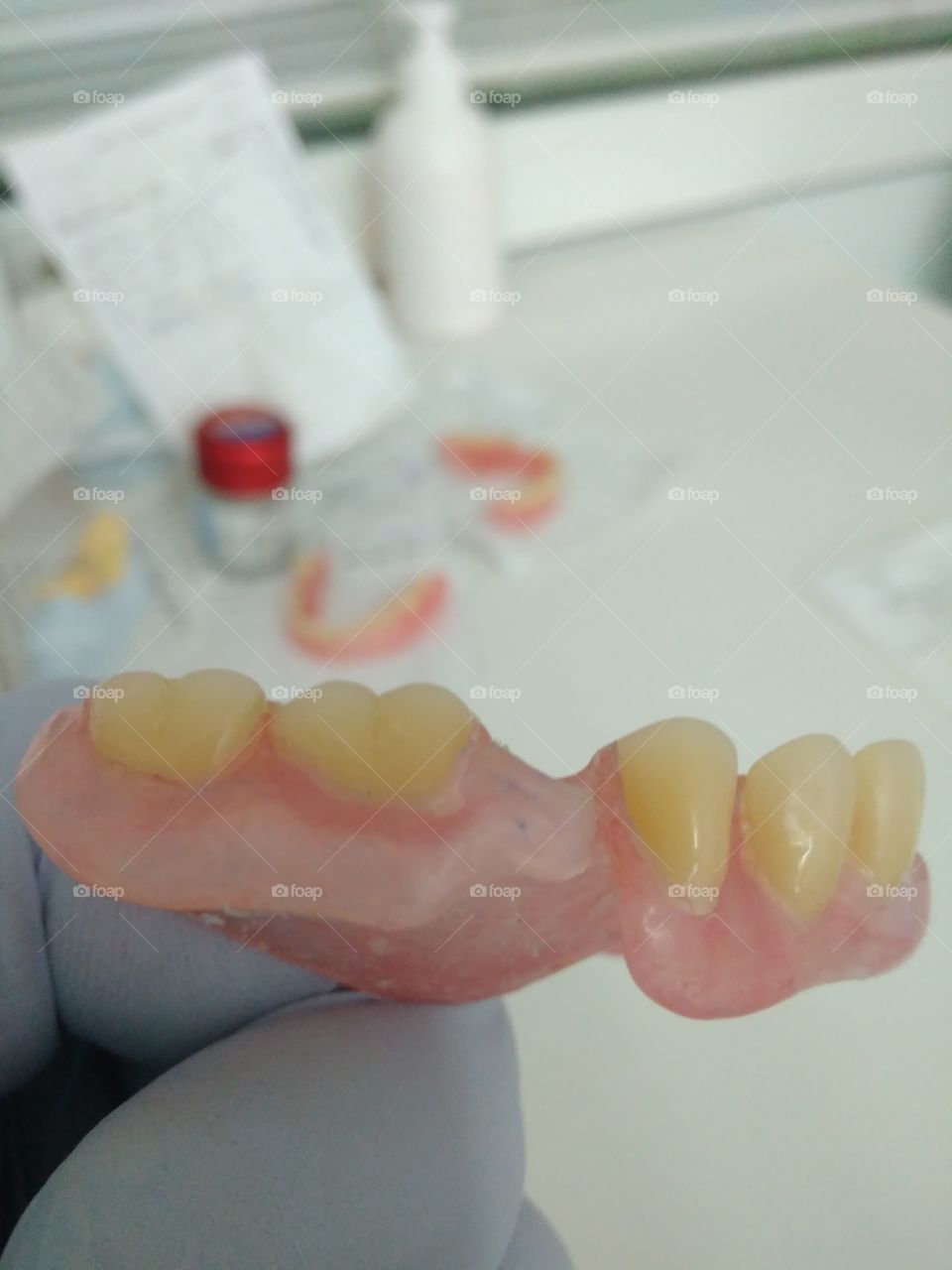 Nylon dentures
