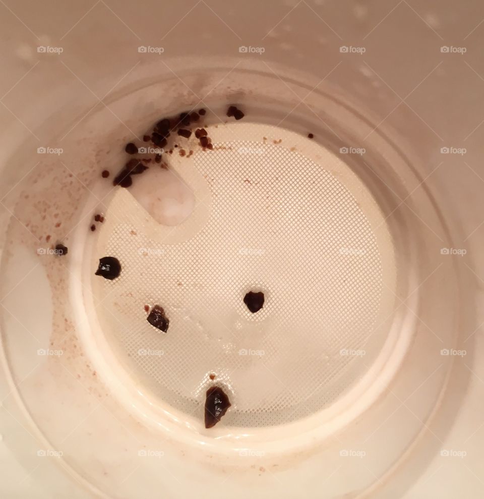 Kidney Stone Fragments