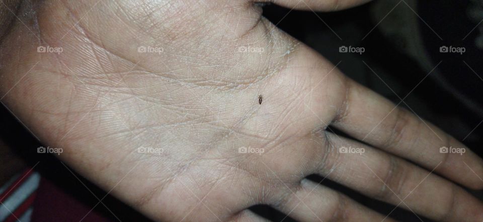 human hair tick caught in camera