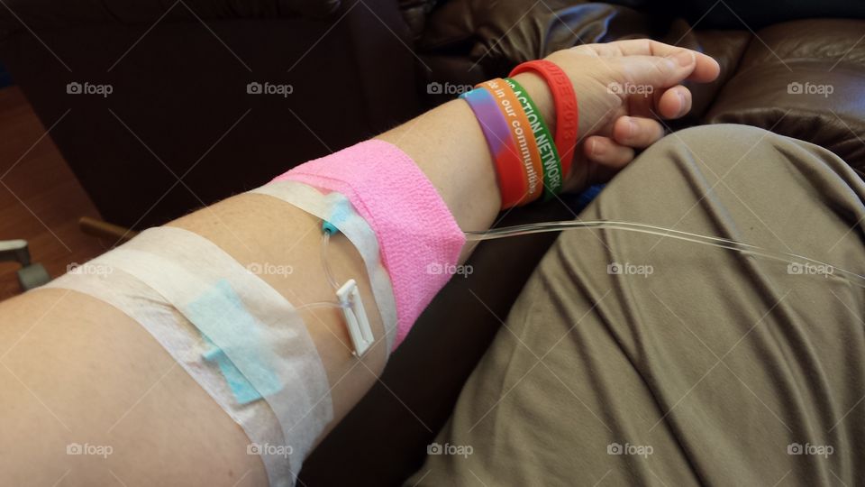 Multiple Sclerosis Treatment. Tysabri infusion every 28 days