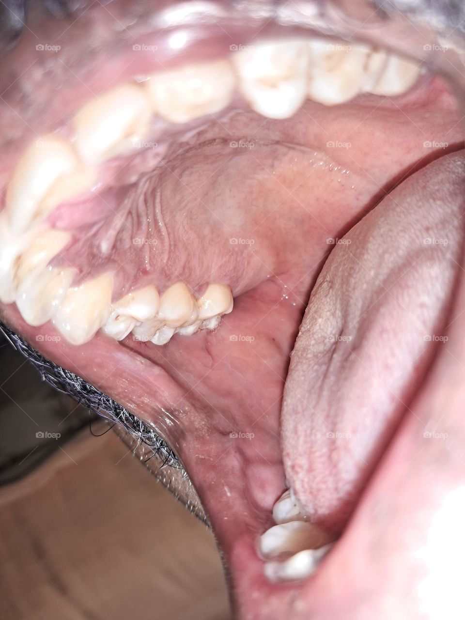 Mouth