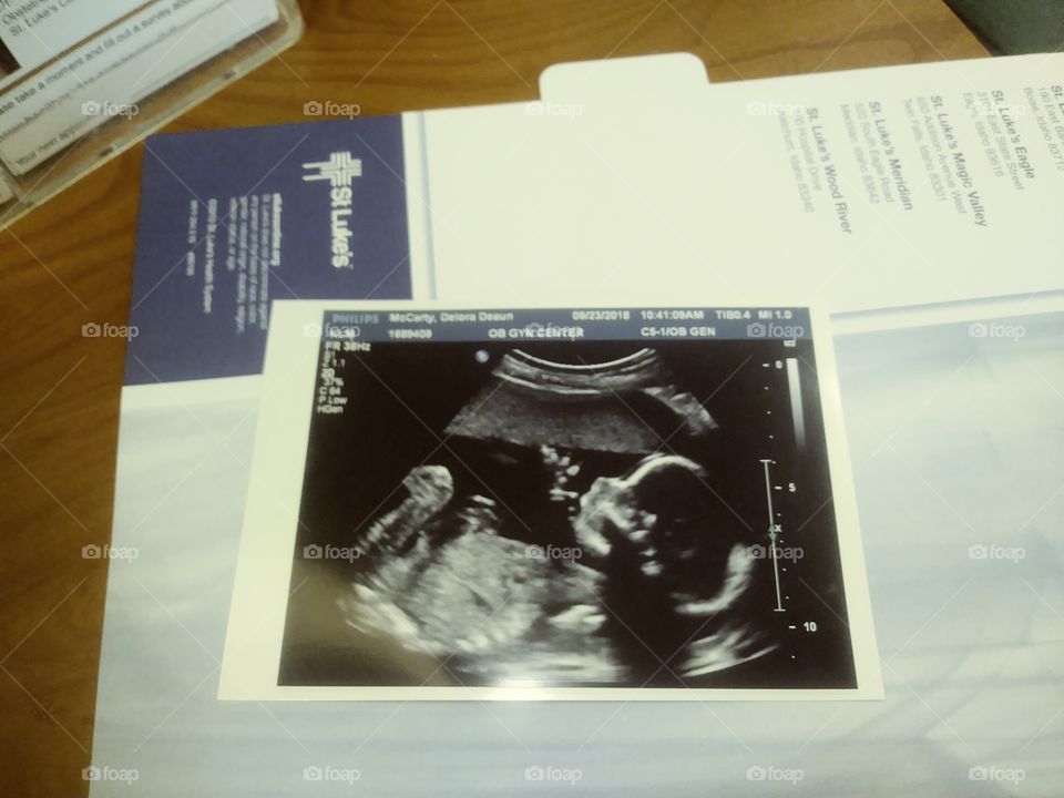 our little addition it a baby girl