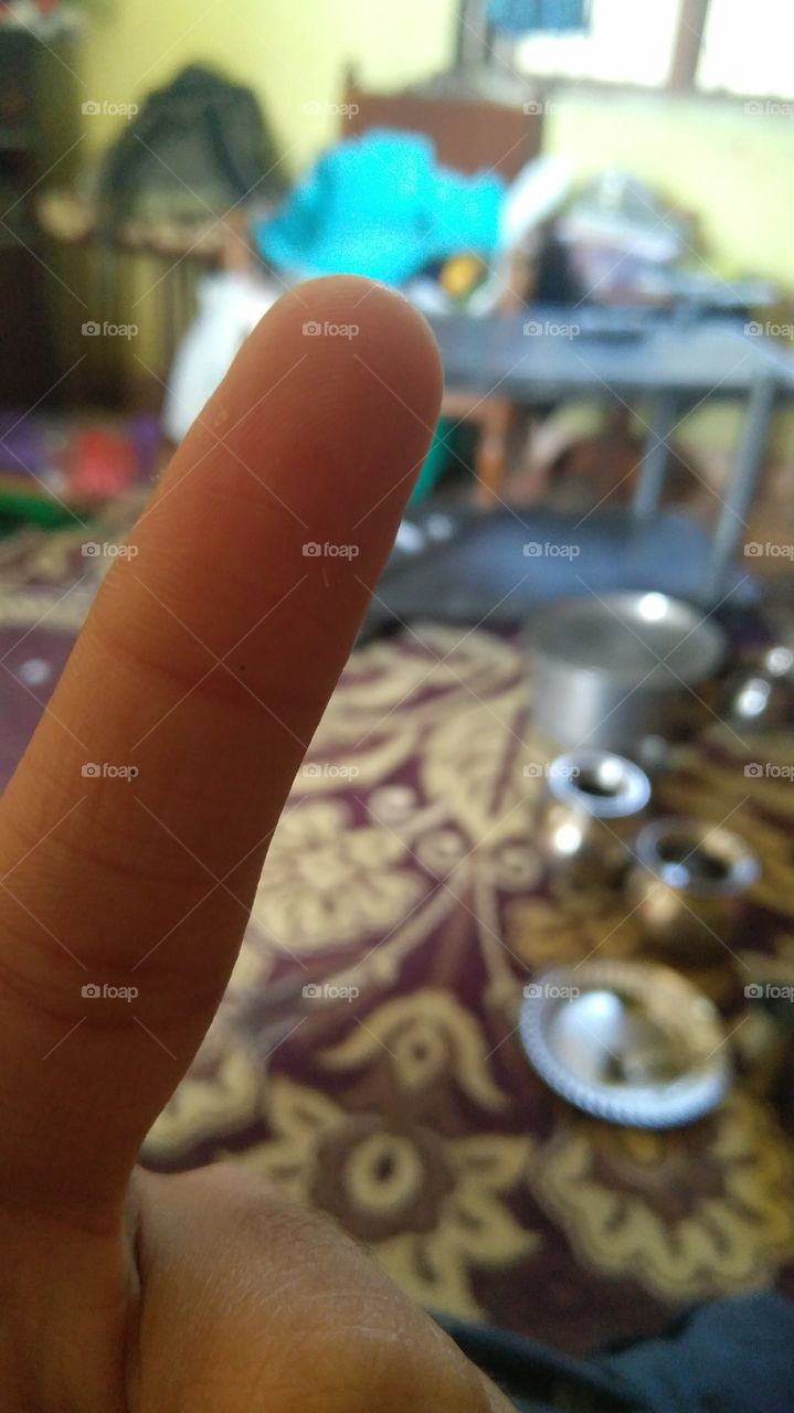 My magnified finger.