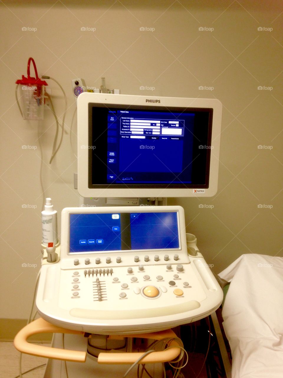 Echocardiogram