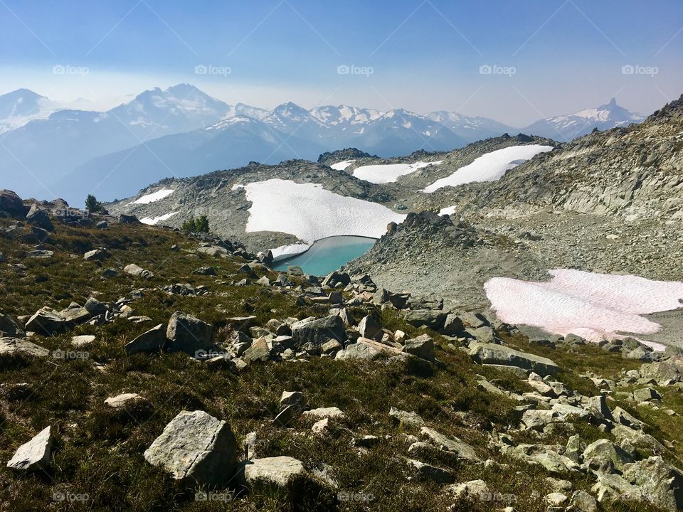 Whistler Mountain