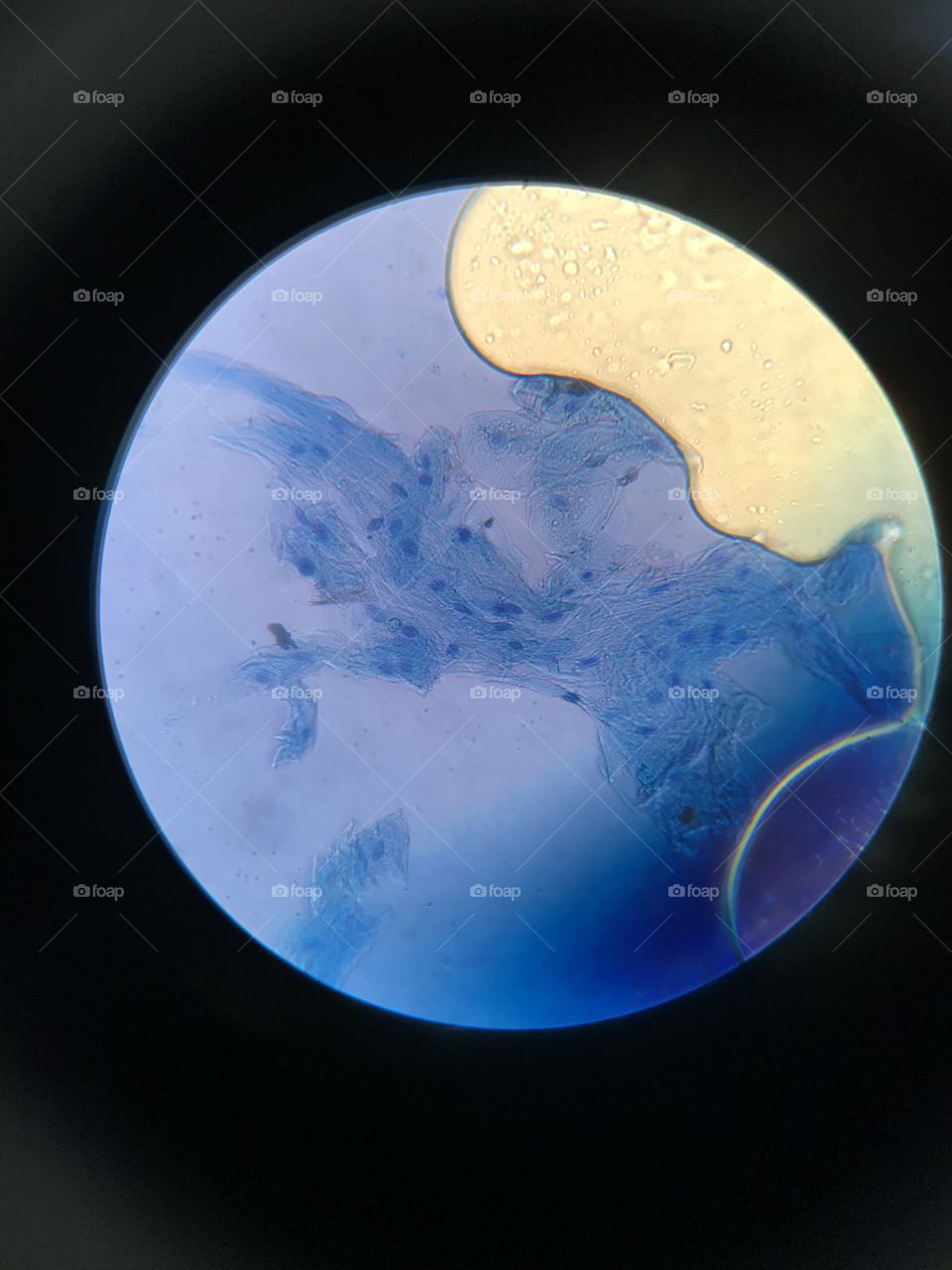 Blue stained cluster of cheek epithelial cells. Unique peek into the usually unseen. Cells with nuclei present make an awesome image for everyone especially science lovers to appreciate 