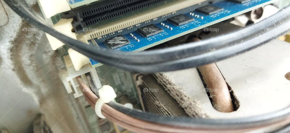 computer brain :surgery