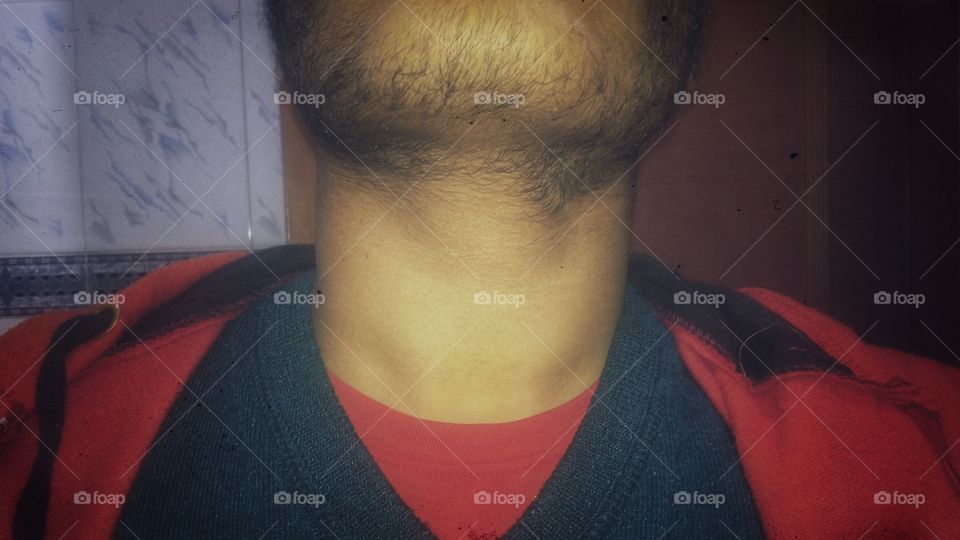Beardy chin