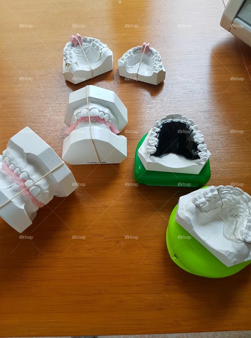 Dental prosthesis 