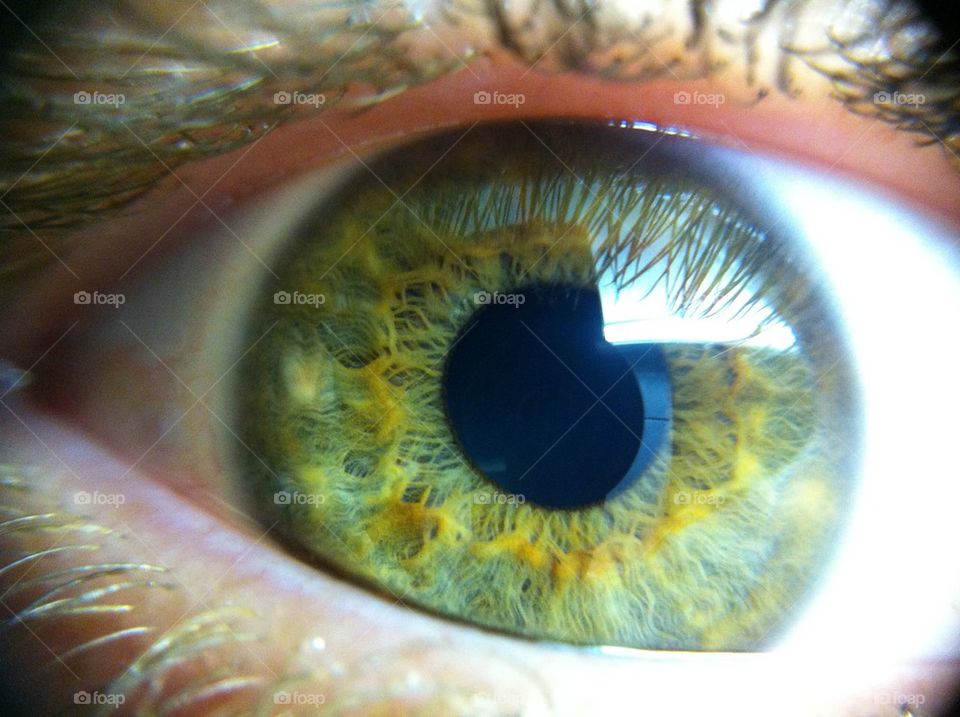 Eye