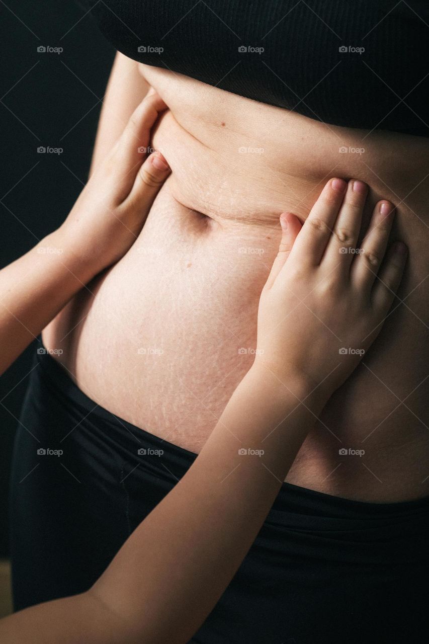 a woman's stomach after the birth of a child, stretch marks on the skin. The concept of loving your body and taking care of yourself. Touching moments of motherhood.