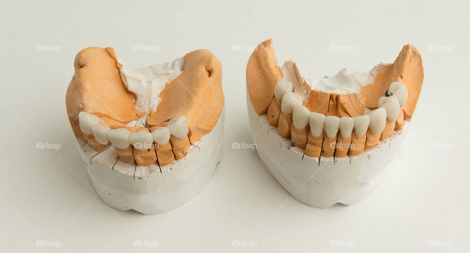 Dental composition