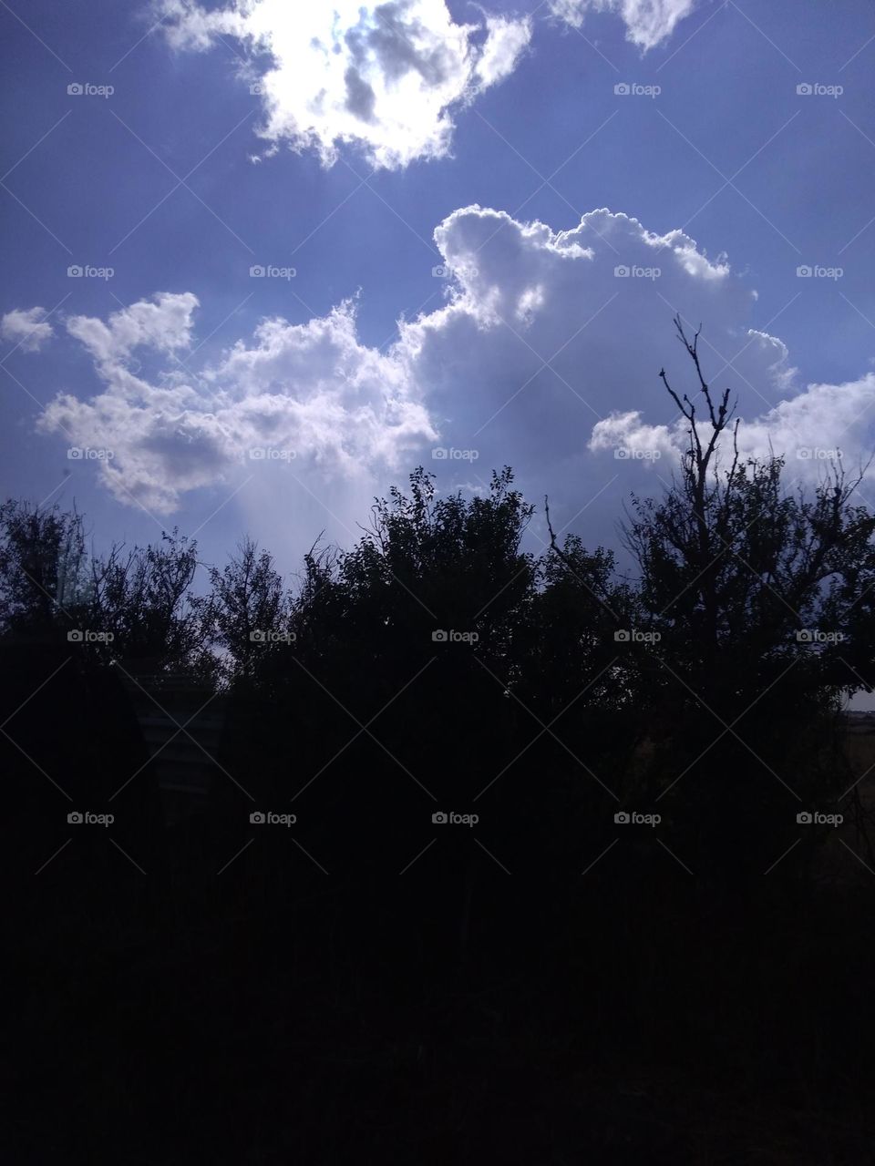 Battle: Countryside vs City