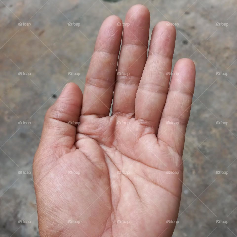 The hand has two definitions The broad definition is the limb from the elbow to the fingertips