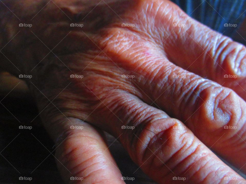 aging hand