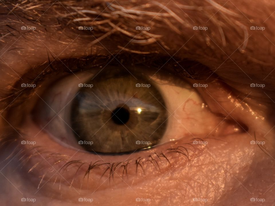 Eye