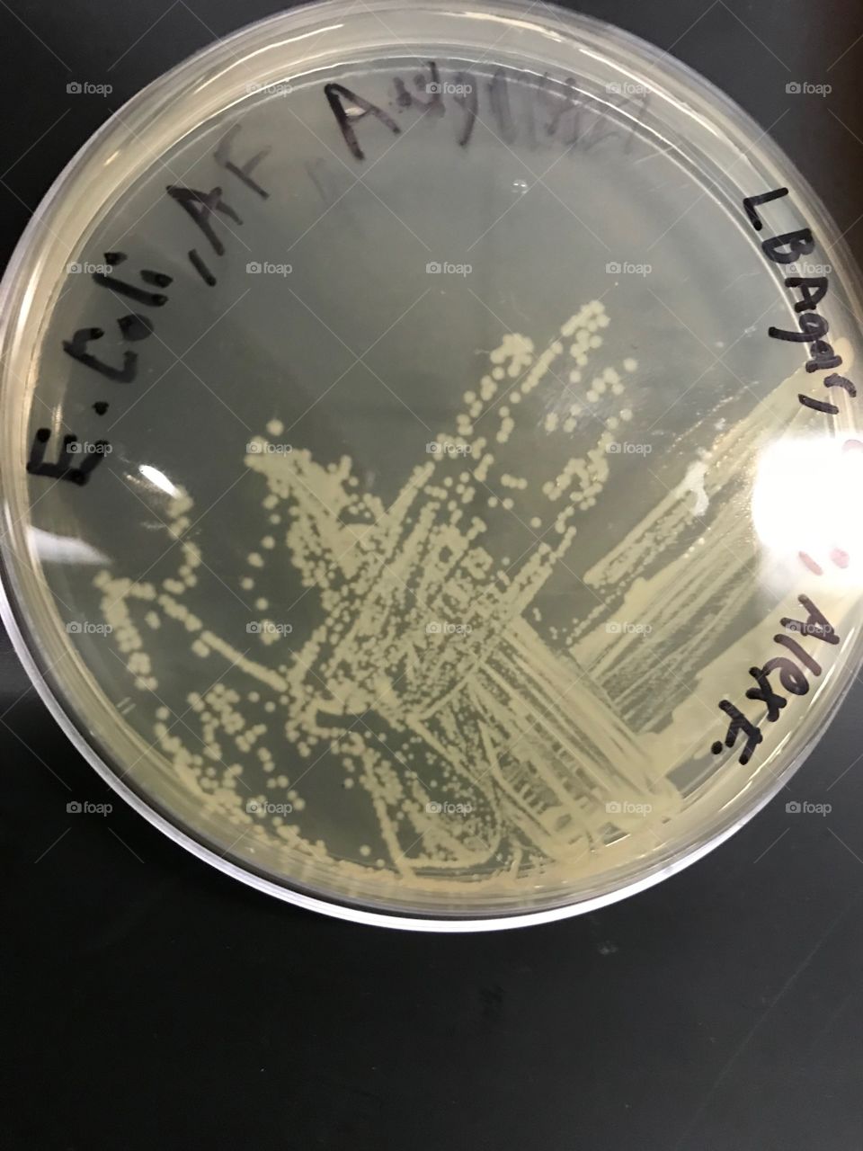 E. coli streaked across LB agar plate that can b observed in separate isolated colonies- the single dots are the colonies.
