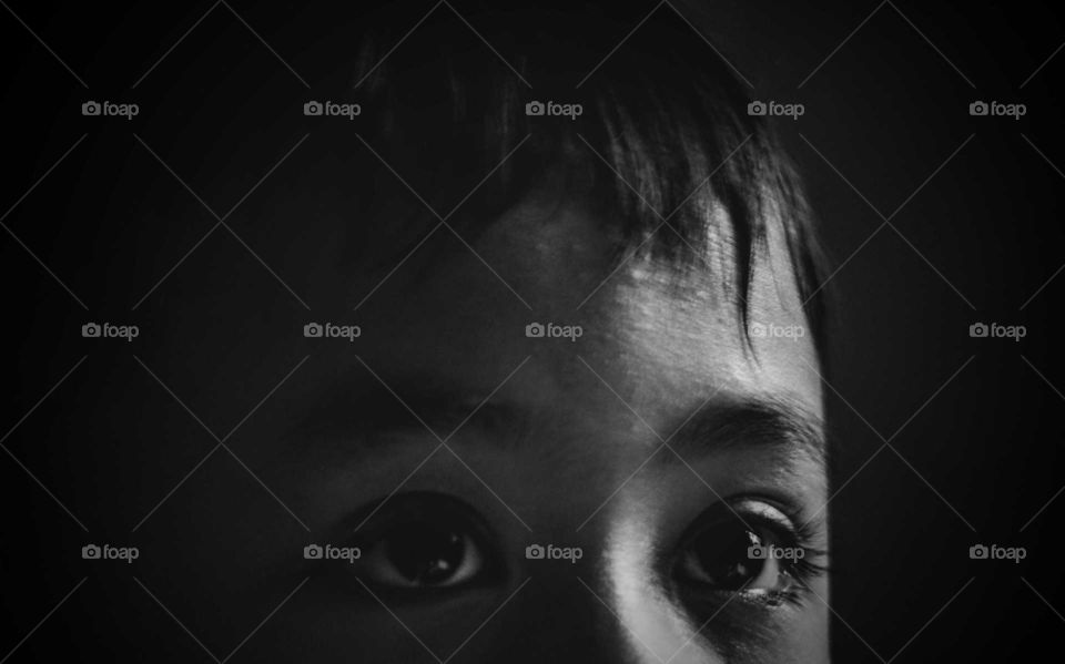 The Black and White of Child Eyes