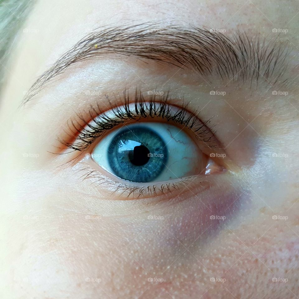 blue eye