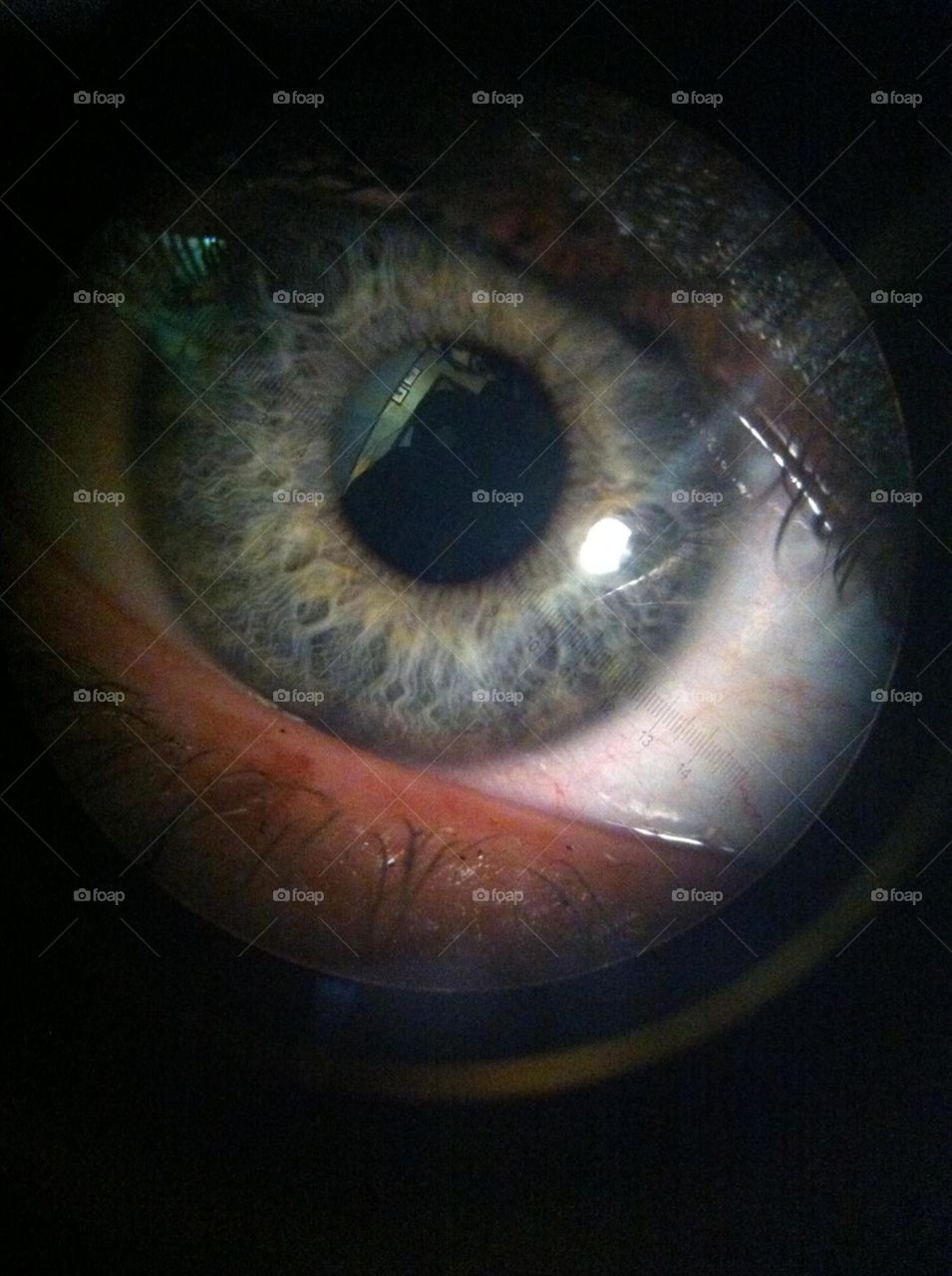 Iris. Very cool iris patterns from an ophthalmologist slit lamp camera