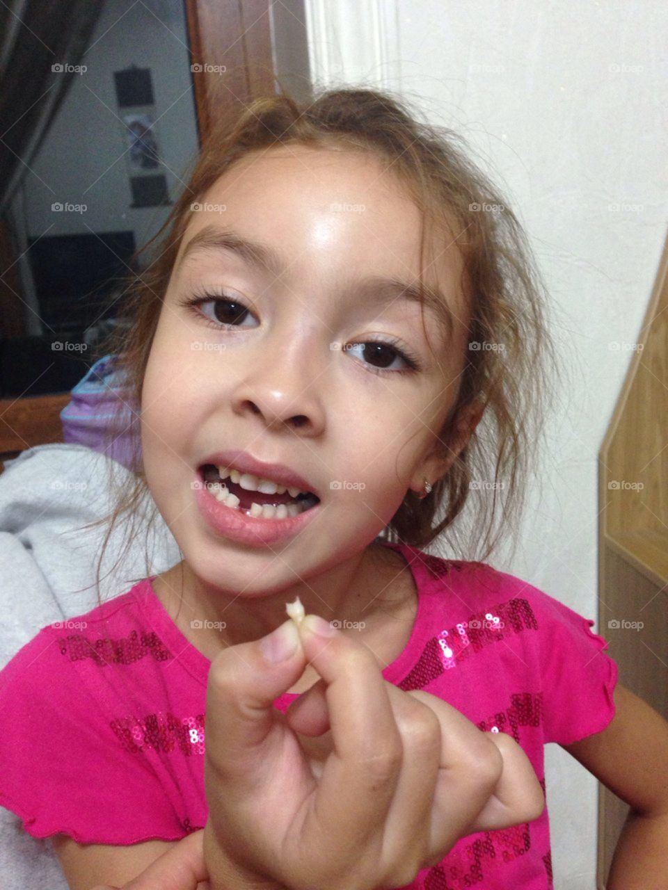 1 tooth down 19 to go...