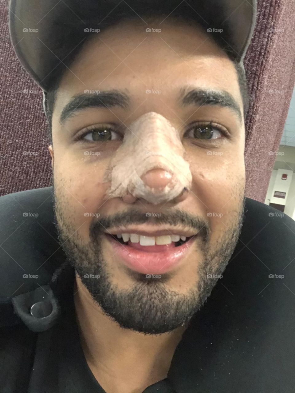 If life gives u lemons, a simple operation can give ya melons! 🛠👃🏽