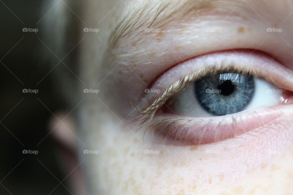 Eye