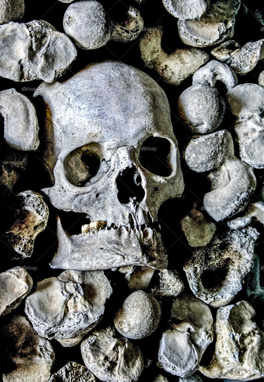 A human skull with 2 teeth still remaining, sits amongst a pile of bones