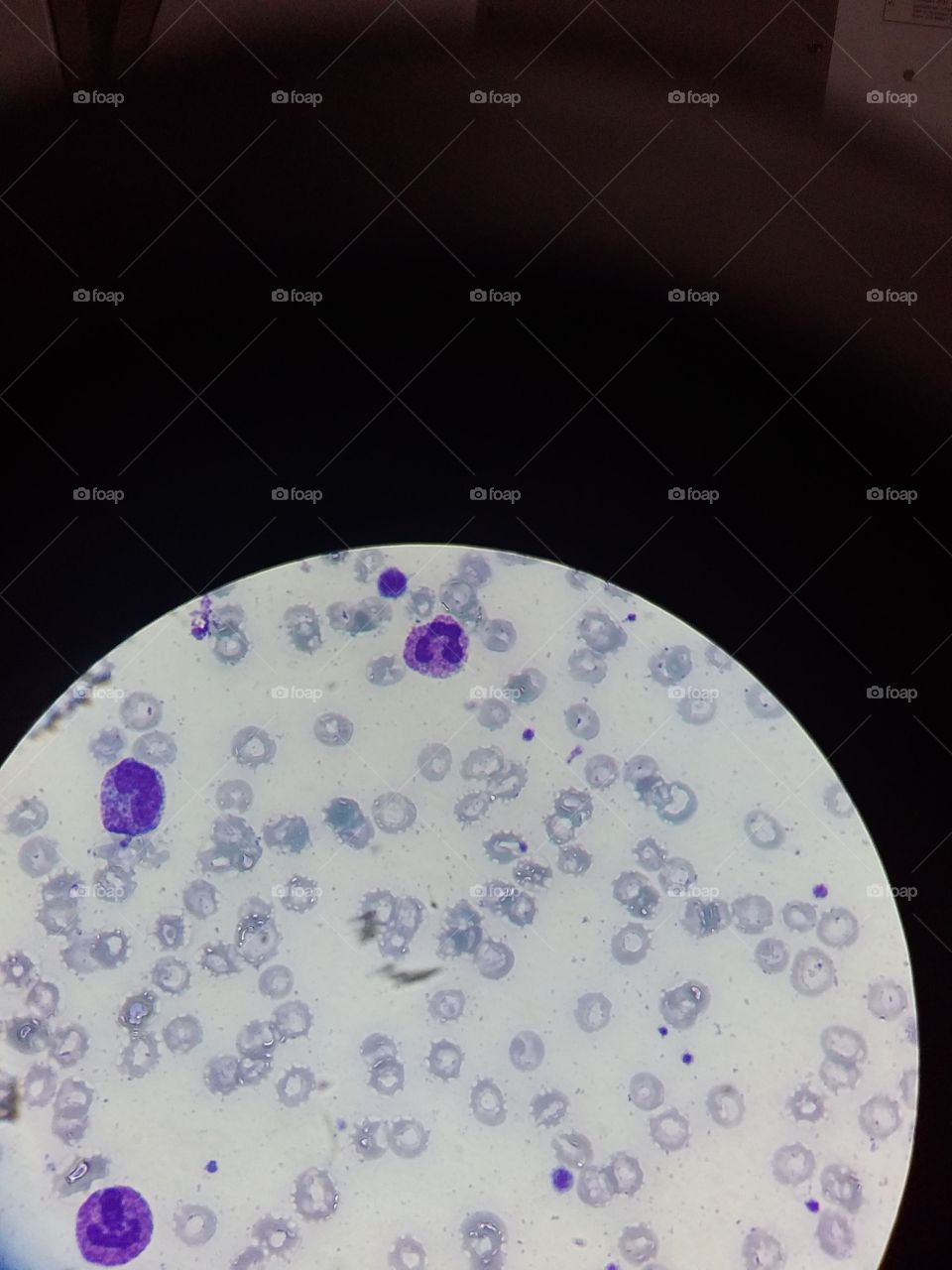 células jovens no sangue
