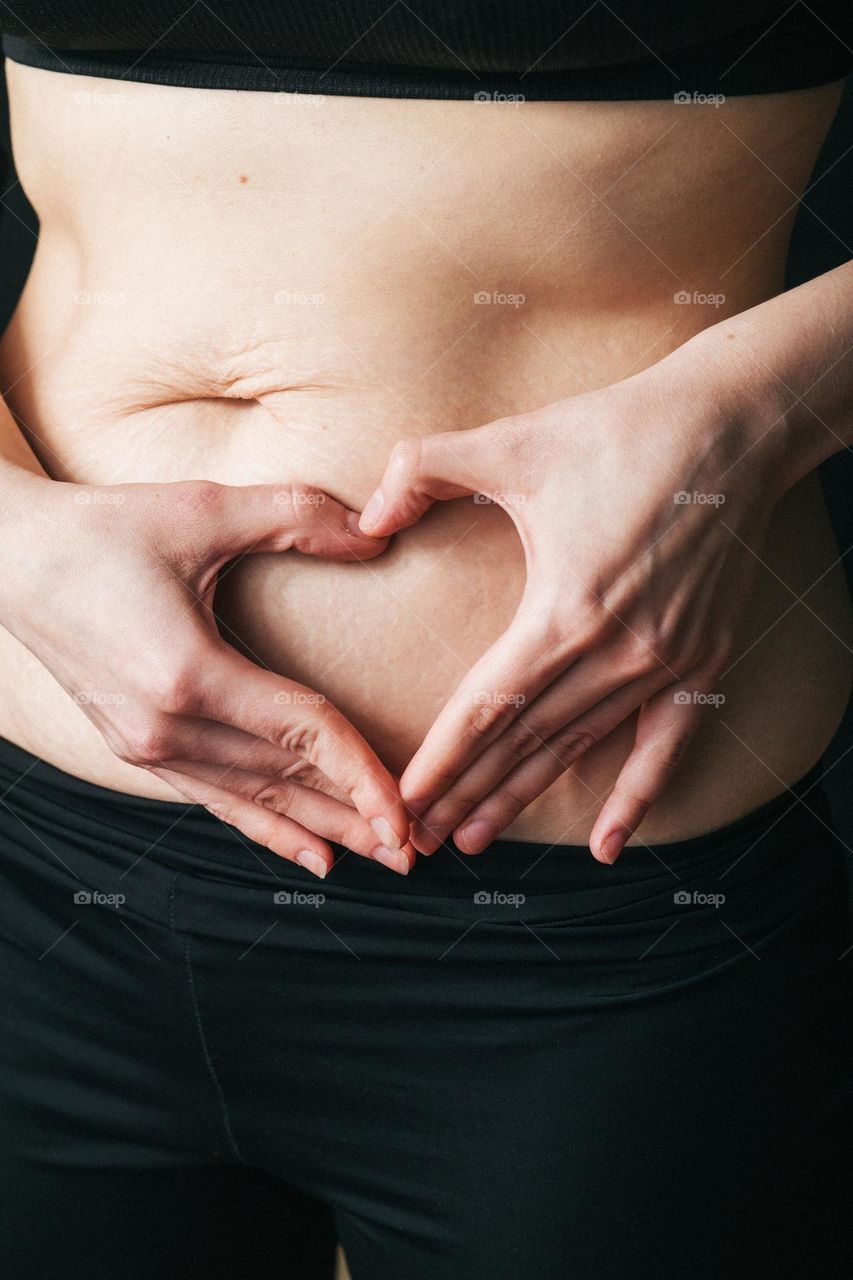 a woman's stomach after the birth of a child, stretch marks on the skin. The concept of loving your body and taking care of yourself. Touching moments of motherhood.