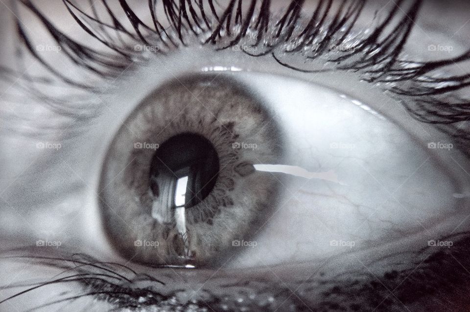 Diana eye