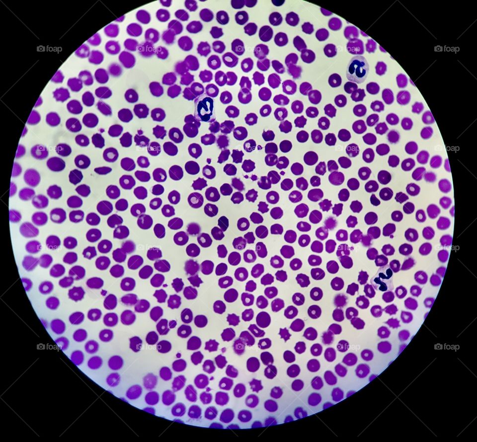 Bacteria sample in dish