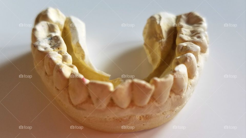 Dental crown molding
