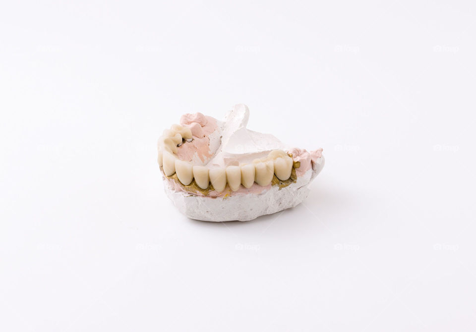 Ceramics dentures