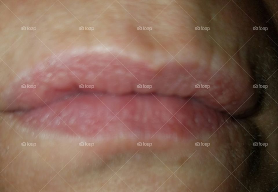 lips