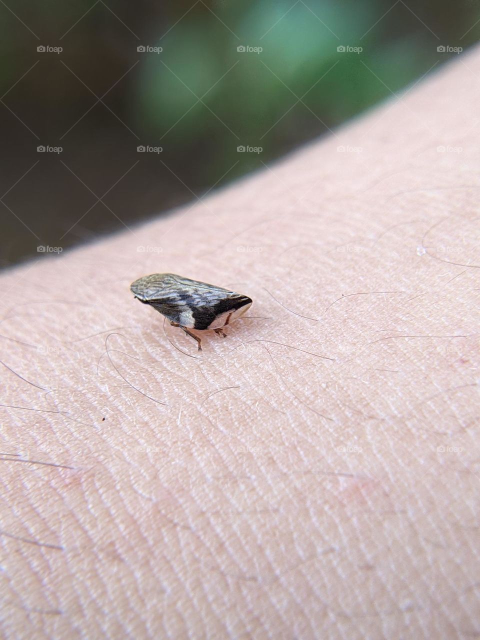 an insect landed on his arm