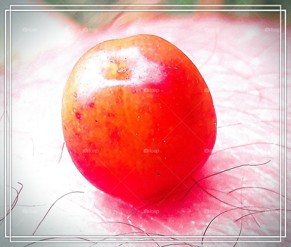 a cherry on the knee