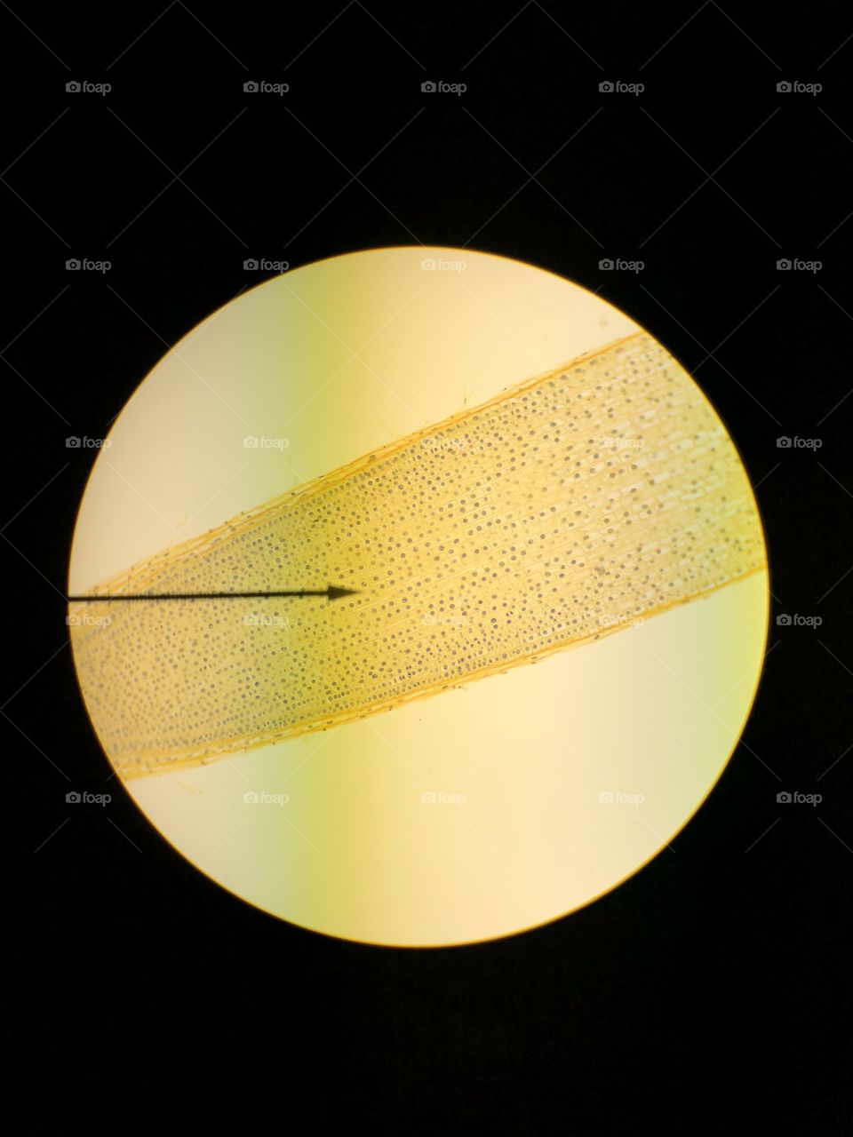 A photo through a microscope