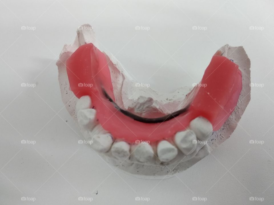Wax dentures