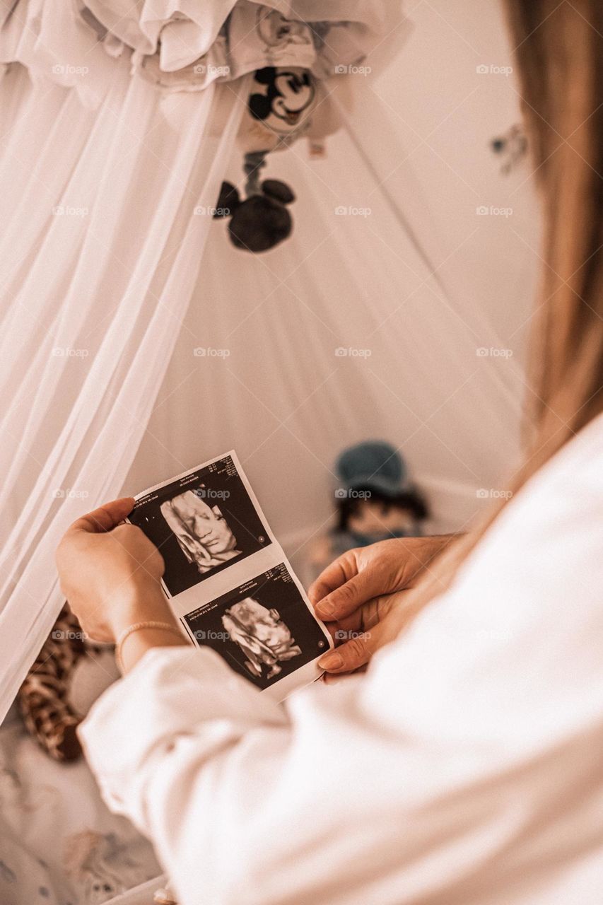 Couple hold onto the ecography picture of their unborn baby boy, while patiently waiting beside his bed